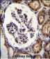 ITGA8 Antibody (C-term)